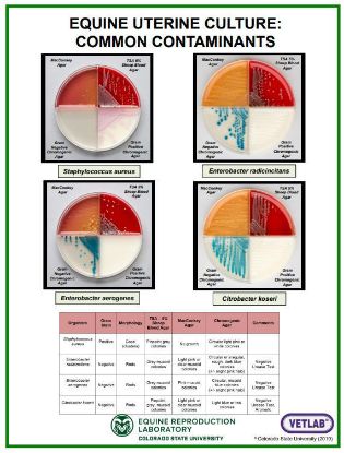 Picture of Uterine Culture Contaminants Poster 