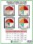 Picture of Uterine Culture Contaminants Poster 